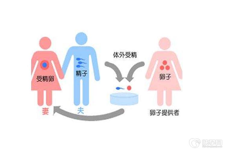 供卵生子流程_供卵生子流程：一窥生殖医学的奇妙世界