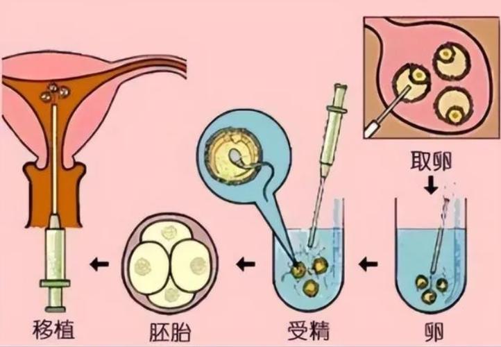 供卵试管代怀是什么-供卵试管代怀:解析未来生育选择